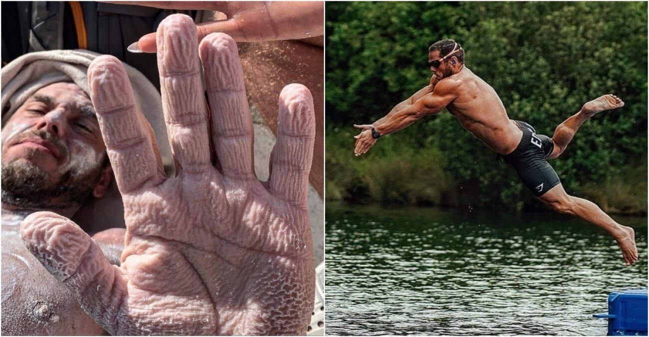 Βρετανός προσπάθησε να σπάσει ρεκόρ και έπαθε θερμοπληξία - Πώς έγινε το σώμα του μετά από 27 ώρες στο νερό - Δείτε εικόνες και βίντεο