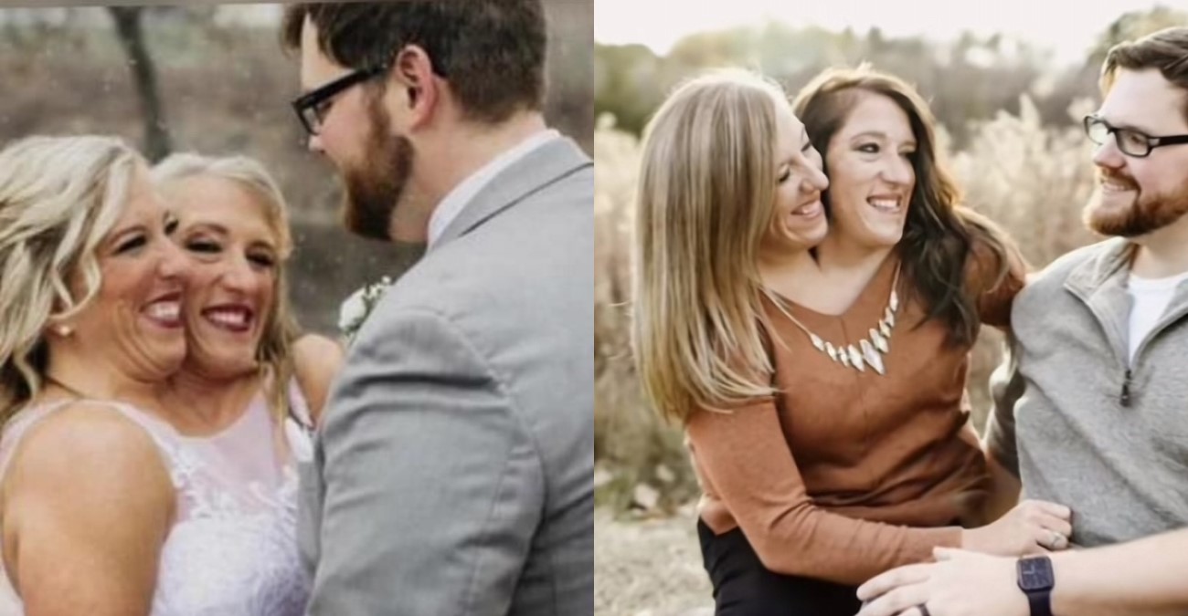Abby και Brittany Hensel: Mία από τις πιο διάσημες σιαμαίες αδελφές των ΗΠΑ είναι πλέον παντρεμένη