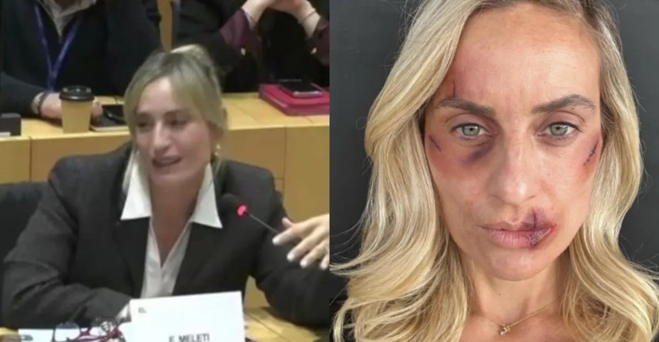 Ελεονώρα Μελέτη: Ξέσπασε σε κλάματα και αποκάλυψε με τρεμάμενη φωνή πως έπεσε θύμα κακοποίησης από σχέση της