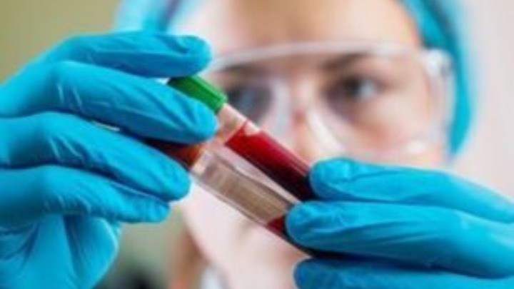 ΕΡΕΥΝΑ: Εξέταση αίματος εντοπίζει τον καρκίνο των ωοθηκών έως και δύο χρόνια νωρίτερα