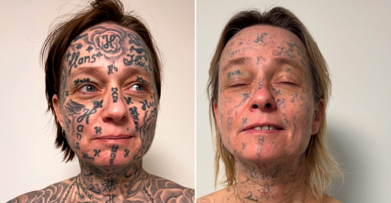 Απίστευτη κακοποίηση: Έκανε τατουάζ 250 φορές το όνομά του στο κορμί της κοπέλας του