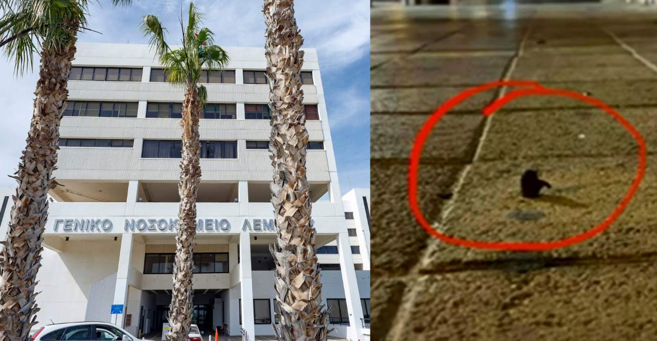 VIDEO: Σκόνταψε σε σίδερο που προεξείχε σε πεζοδρόμιο και μπήκε χειρουργείο – Η ταλαιπωρία στο Γ.Ν.Λεμεσού -  «Ένιωσα σαν να είμαι σε τριτοκοσμική χώρα»