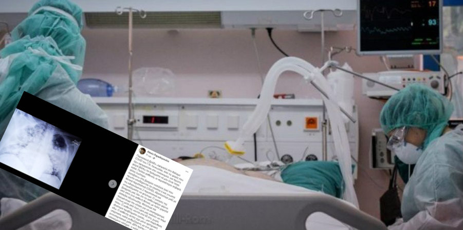 ΚΥΠΡΟΣ: Μαρτυρία γιατρού από Γ.Ν. που συγκλονίζει  -  Ο ασθενής που «έφυγε», τα εμβόλια και οι αρνητές της πανδημίας