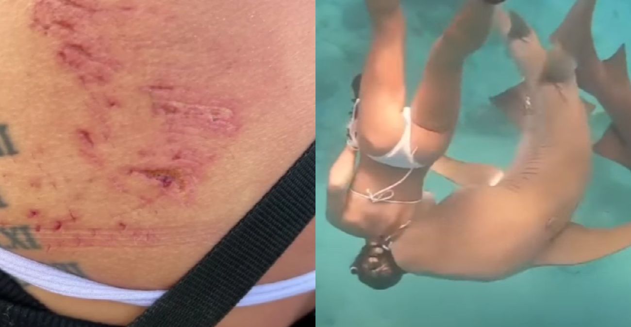 Μαλδίβες: Στιγμές τρόμου για κολυμβήτρια – Τη δάγκωσε καρχαρίας 100 κιλών