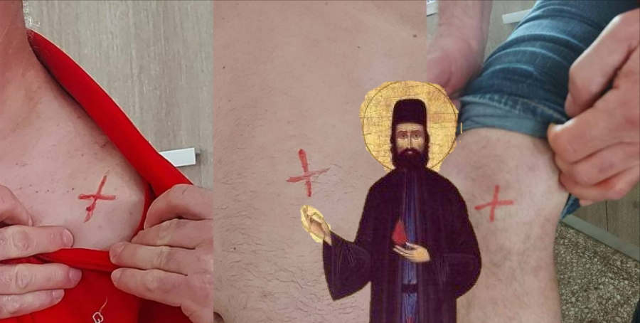 Το νέο θαύμα του Αγίου Εφραίμ σε Κύπριο – Οι Σταυροί στο σώμα του και τα καθαρά αποτελέσματα που το μαρτυρούν 