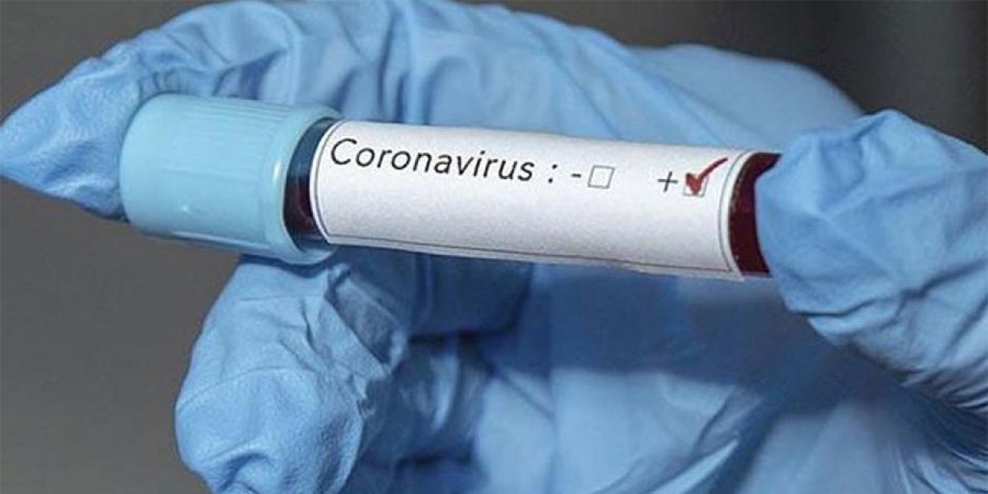 ΚΥΠΡΟΣ - ΚΟΡΩΝΟΪΟΣ: Ανακοινώθηκαν τα νέα περιστατικά του ιού για την Κυριακή (28/11) - ΠΙΝΑΚΕΣ