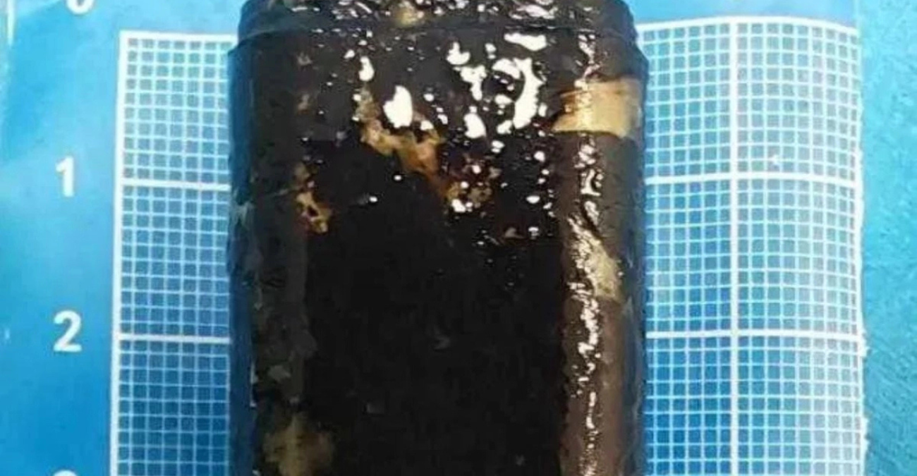 Κίνα: Κατάπιε αναπτήρα για challenge και 30 χρόνια μετά λειτουργούσε