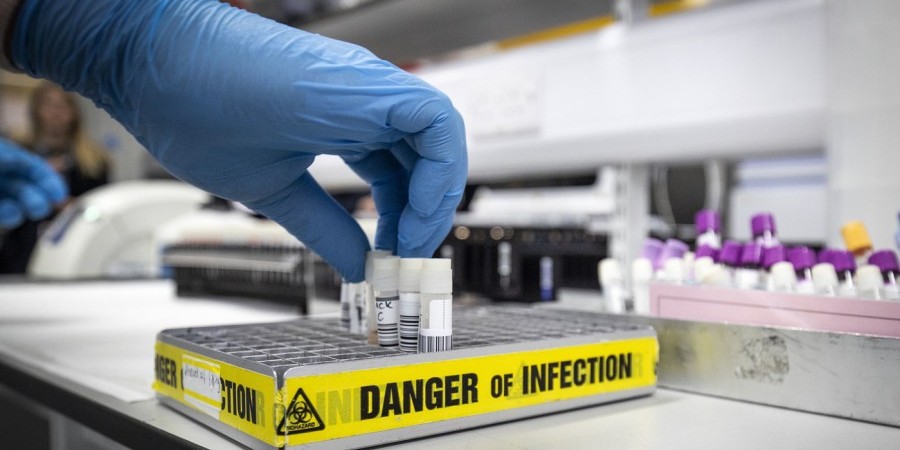 ΚΥΠΡΟΣ - ΚΟΡΩΝΟΪΟΣ: Ξεκάθαρη απάντηση για το  λόγο που μειώθηκαν οι εργαστηριακές εξετάσεις για τον ιό