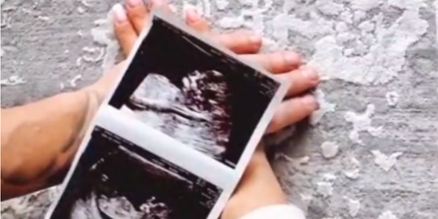 Baby boom! Έγκυος στο πρώτο της παιδί γνωστή Κύπρια – Το ανακοίνωσε με ένα τρυφερό βίντεο