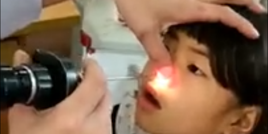 Πήγε στον γιατρό με ενόχληση στη μύτη – Έφριξε η μικρή μόλις το έβγαλε – VIDEO
