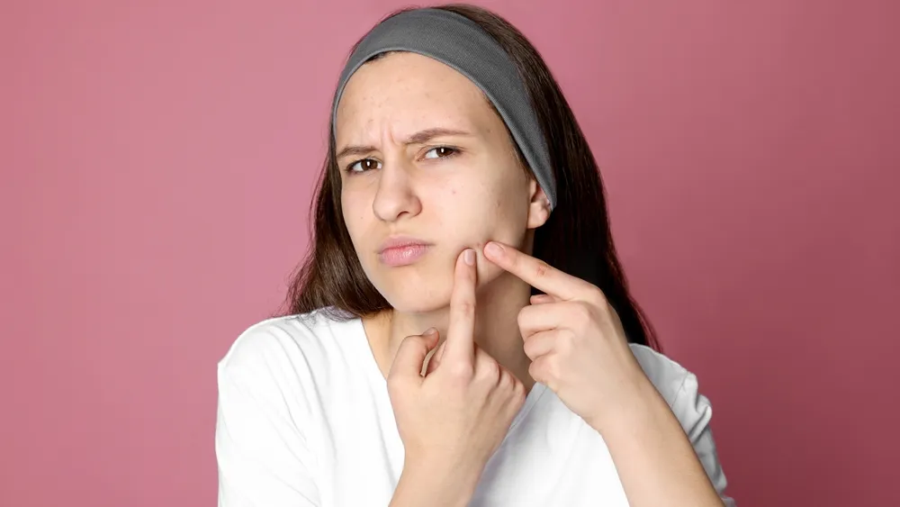 Μην «σπάτε» τα σπυράκια: 5 tips των ειδικών για υγιές εφηβικό δέρμα – Οι τάσεις του TikTok που απομυθοποιούν