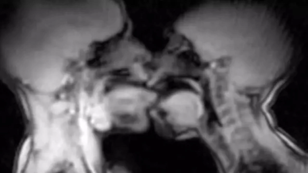 Έκαναν σεξ μέσα σε μαγνητικό τομογράφο και...κατέληξαν σε επιστημονική ανακάλυψη - Τι έδειξαν οι εικόνες του MRI