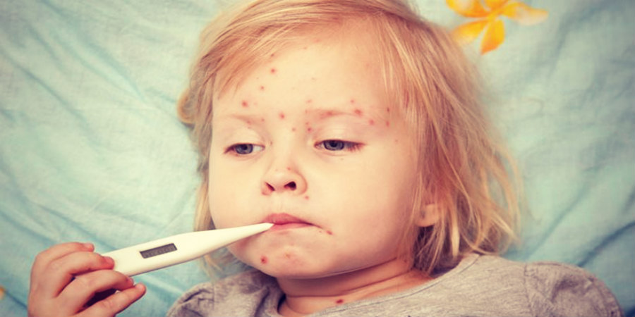 Συναγερμός για την ιλαρά σε όλη την Ευρώπη - Αυξήθηκαν τα κρούσματα φέτος!