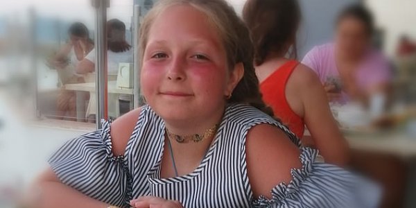 Νεκρή 12χρονη σε πισίνα ξενοδοχείου - Τη ρούφηξε η αντλία νερού - ΦΩΤΟΓΡΑΦΙΕΣ