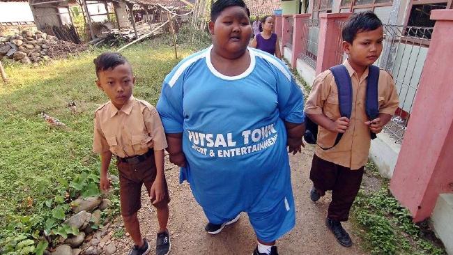 To πιο παχύσαρκο παιδί, έχασε 76 κιλά και πλέον μπορεί να παίζει! ΦΩΤΟΓΡΑΦΙΕΣ