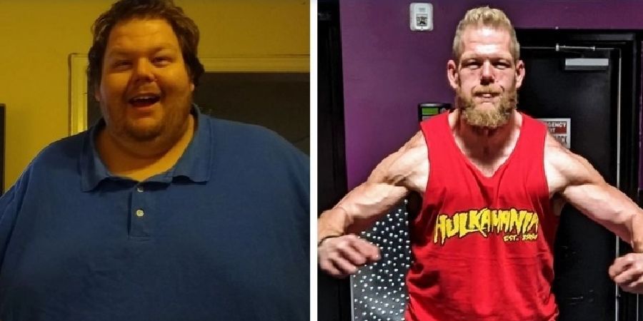 Κατάφερε και έχασε 150 κιλά αλλά... το δέρμα του κρέμασε - Δείτε τη viral φωτογραφία