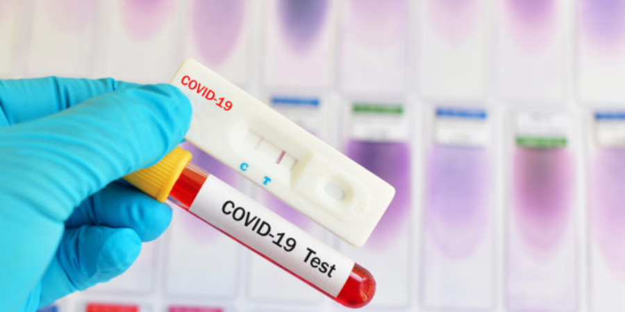 Παραλλαγή Όμικρον: Αρνητικό rapid test και θετικό μοριακό PCR – Γιατί συμβαίνει και ποιος είναι ο κίνδυνος