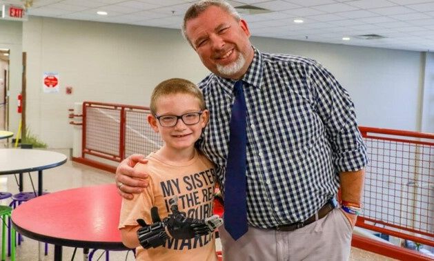 Δάσκαλος έκανε το θαύμα του: Σχεδίασε πρόσθετο χέρι για ΑμεΑ μαθητή με κόστος... 30 δολάρια