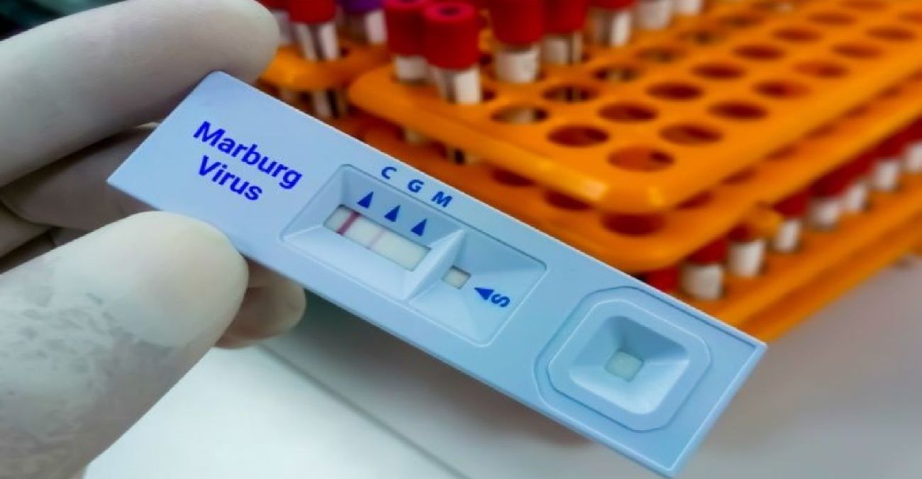 Όλα όσα πρέπει να γνωρίζουμε για τον ιό Marburg – Τι συστήνει το Υπουργείο Υγείας