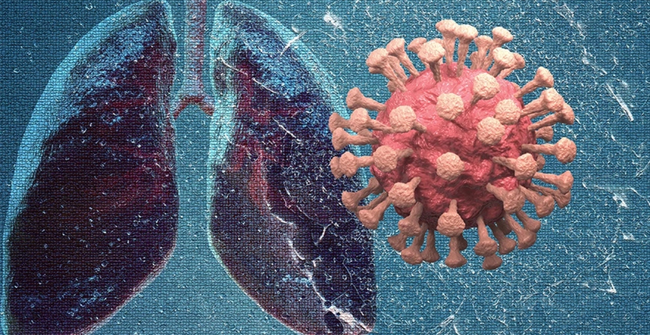 Απρόσμενη ανακάλυψη για τον κορωνοϊό: Βρέθηκε πρωτεΐνη στους πνεύμονες που τον μπλοκάρει