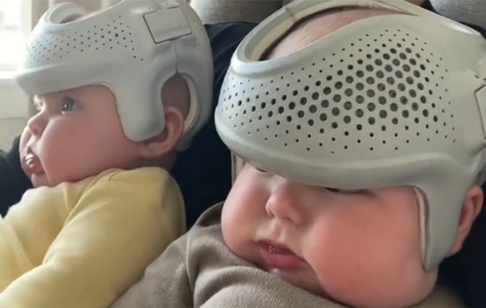 Μητέρα φοράει στα μωρά της κράνη για 23 ώρες το 24ωρο – Αντιδράσεις στα social media - Δείτε βίντεο