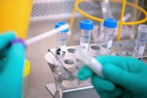 ΚΥΠΡΟΣ – ΚΟΡΩΝΟΪΟΣ: Πού θα κάνετε δωρεάν rapid test την Παρασκευή 18/12