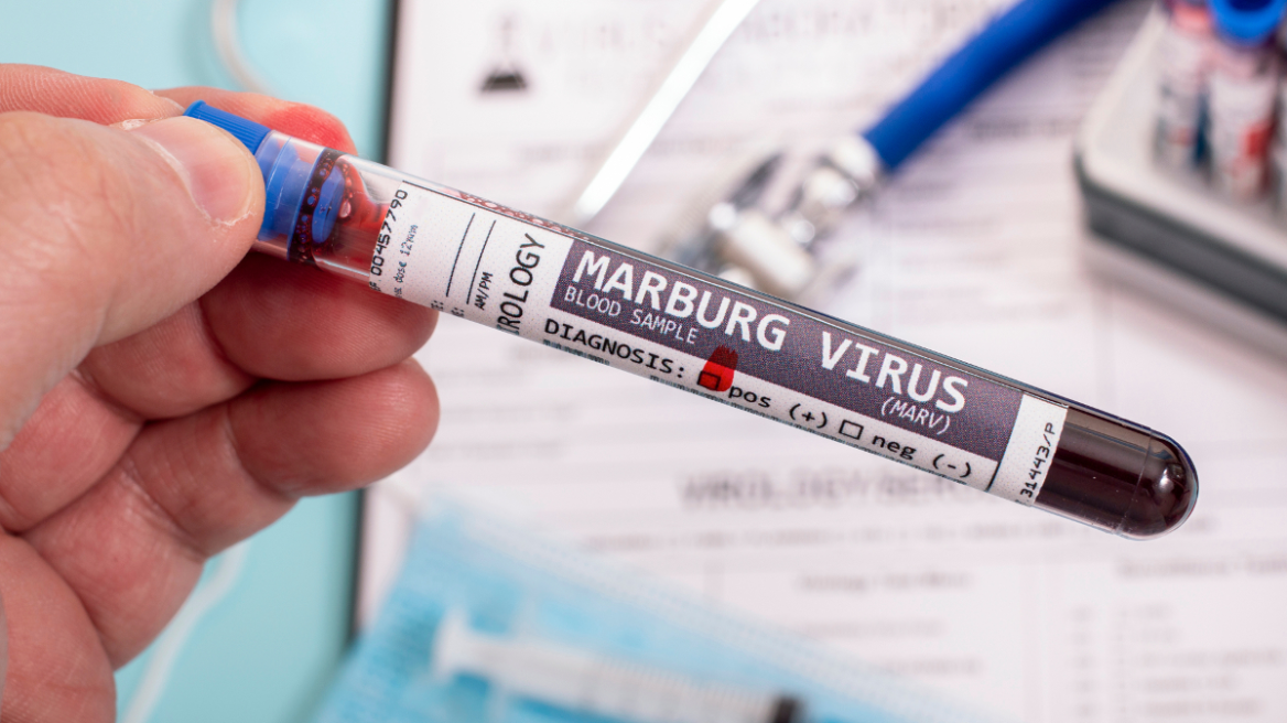 Κρούσματα του θανατηφόρου ιού Marburg ανακοίνωσε η Αιθιοπία - Δεν υπάρχει εγκεκριμένο εμβόλιο ή θεραπεία 