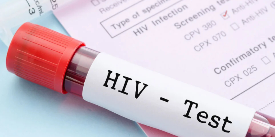 Ανακαλύφθηκε στην Ευρώπη μία νέα, πιο παθογόνα και μεταδοτική, παραλλαγή του AIDS