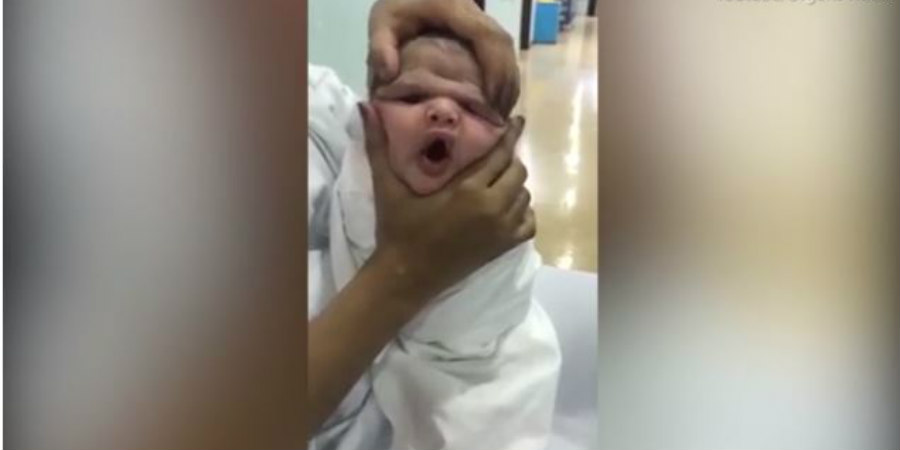 Τρομερό: Νοσηλεύτριες πίεζαν το κεφάλι άρρωστου νεογέννητου και γελούσαν - VIDEO