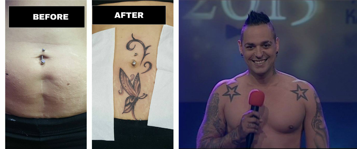Σάββας ΚΤΜ: Κράτησε τον λόγο του! (PHOTOS) Κάνει δωρεάν τατουάζ σε κοπέλες με πρόβλημα στο δέρμα