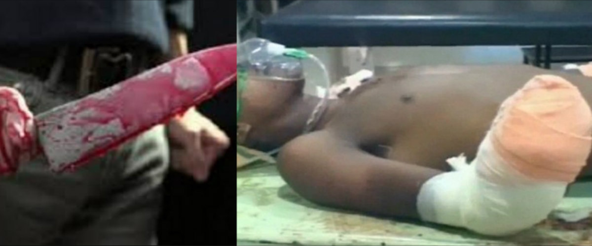 ΣΚΛΗΡΕΣ ΕΙΚΟΝΕΣ: Έκοψε τα χέρια του 17χρονου βιαστή της 7 μηνών κόρης του!