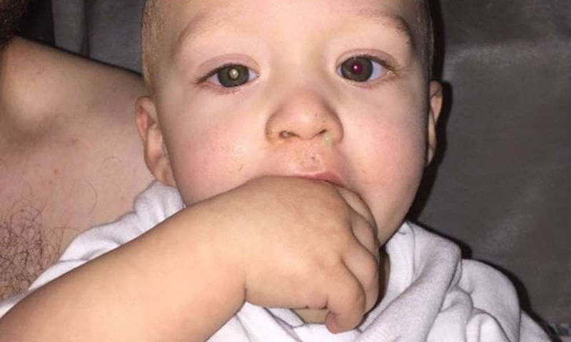 Μπορείτε να διακρίνετε τον καρκίνο στο μάτι αυτού του παιδιού;