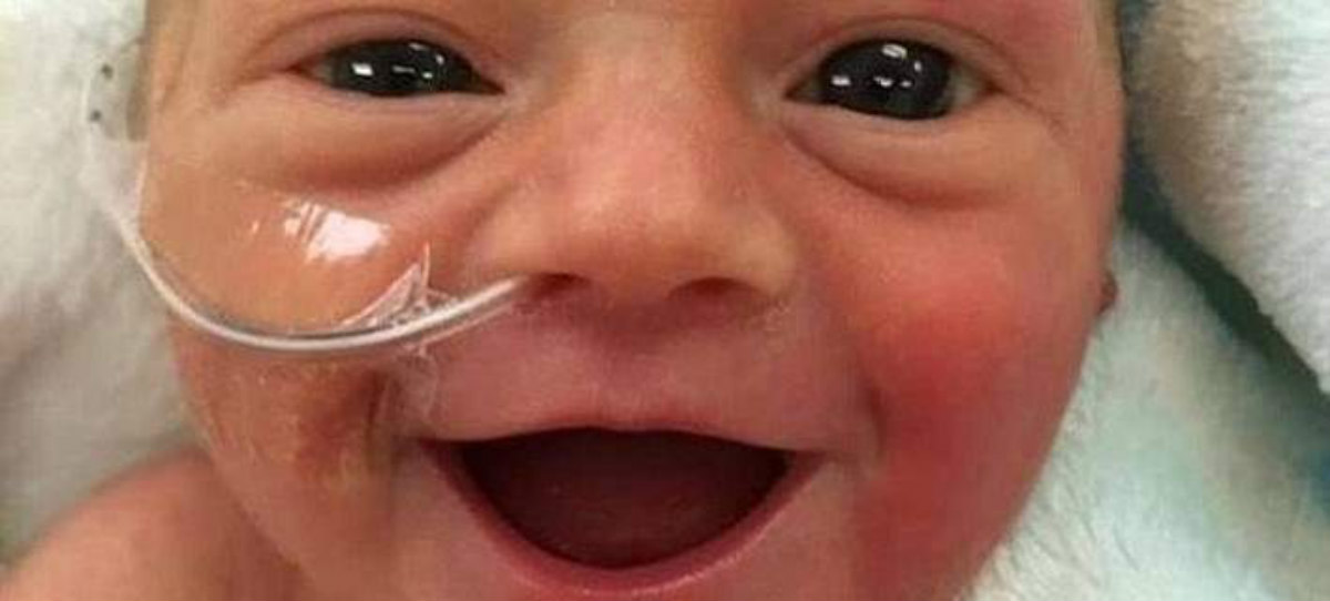 Μοναδική στιγμή: Μωρό μόλις 1.700 γραμ. ξεκαρδίζεται όταν η μητέρα του το παίρνει αγκαλιά