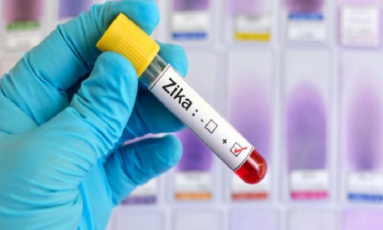 Επιστήμονες στο Ισραήλ αναζητούν θεραπεία για τον ιό Ζίκα