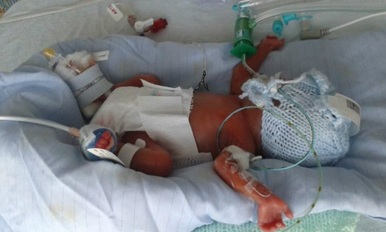 Είδε την φωτογραφία του 35 ημερών νεκρού μωρού της στο Facebook για έρανο