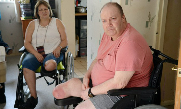 Ανατριχιαστική σύμπτωση: Το ζευγάρι που έχασε από ένα πόδι λίγους μήνες πριν το γάμο του!