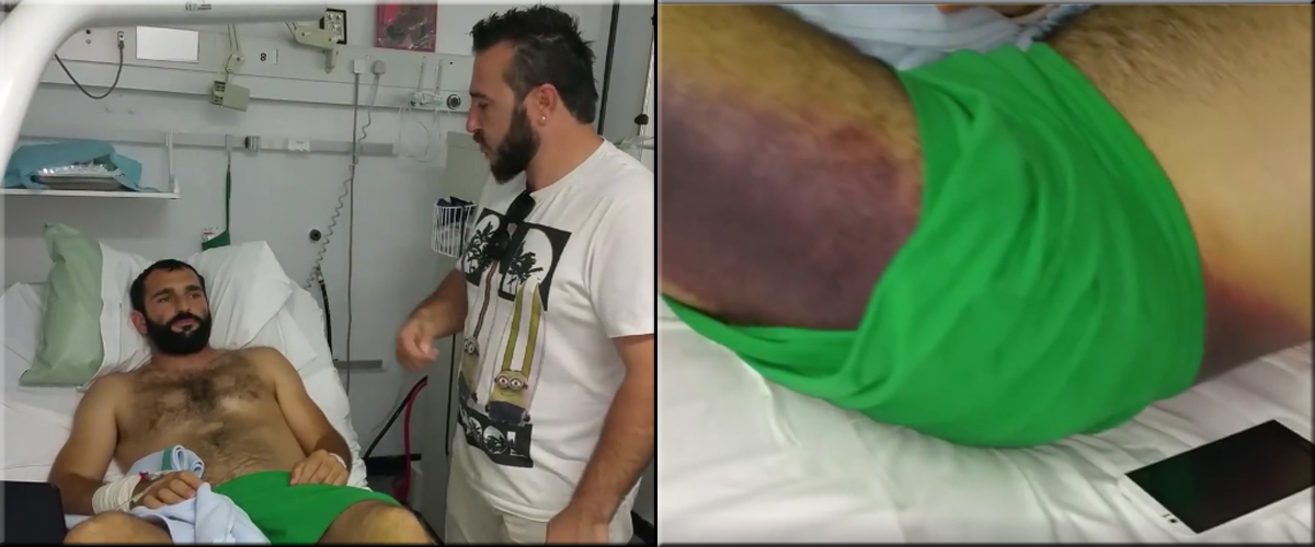 Γ.Ν. ΠΑΦΟΥ: Ο Αλέξης δέχθηκε δάγκωμα από οχιά! – Πώς αντιμετωπίστηκε το περιστατικό – VIDEO