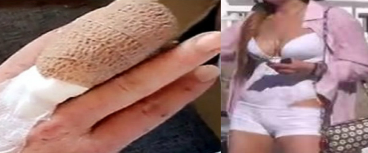Φρικιαστικό! Η ηθοποιός έχασε το μισό της δάχτυλο στα ανοικτά της Τουρκίας!