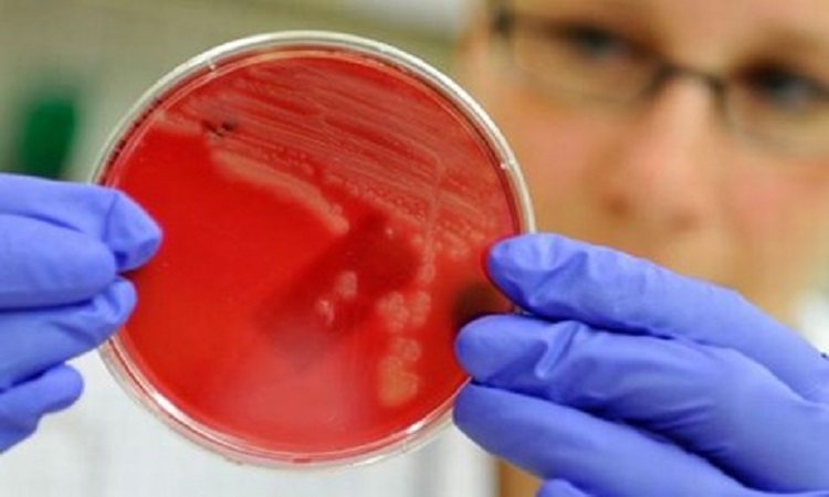 Ανακαλύφθηκαν βακτήρια ανθεκτικά και στα πιο ισχυρά αντιβιοτικά