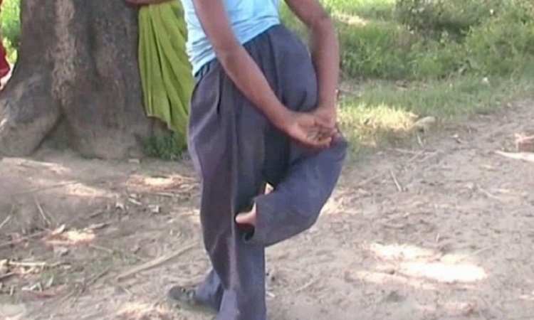 Ινδία: Ο 20χρονος «δαίμονας» με τα τέσσερα πόδια