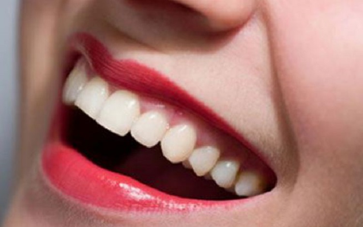 Αυτές οι τροφές κάνουν τα δόντια πιο λευκά
