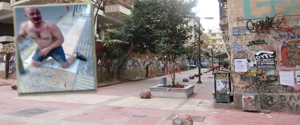 Σοκ προκαλούν οι εικόνες Κύπριου από την Αθήνα – Τον ξυλοφόρτωσαν στα Εξάρχεια