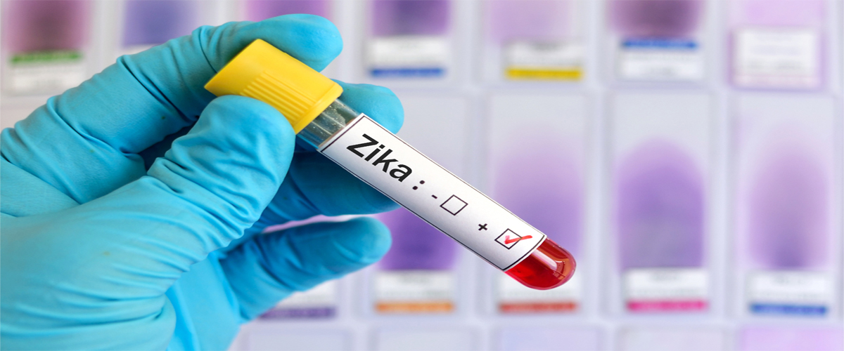 Στην Ισπανία το πρώτο επιβεβαιωμένο κρούσμα εγκύου με ιό Ζίκα στην Ευρώπη!