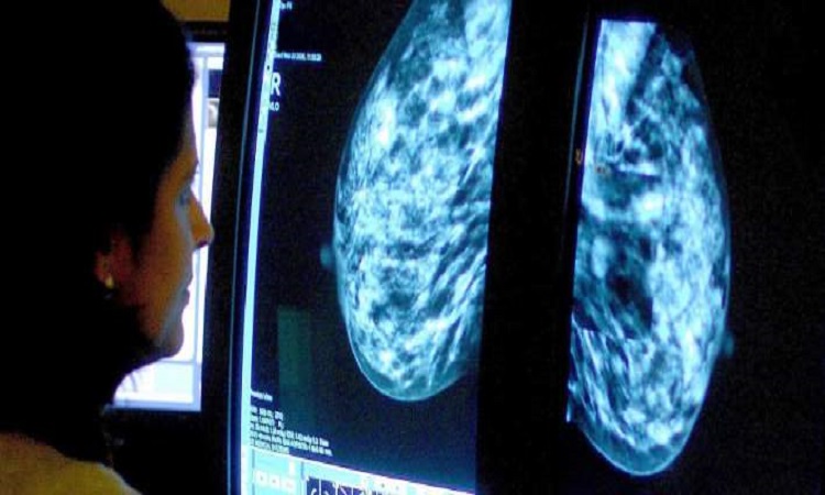 Σπουδαία ανακάλυψη: Συνδυασμός φαρμάκων συρρίκνωσε θεαματικά καρκίνο του μαστού σε 11 μέρες