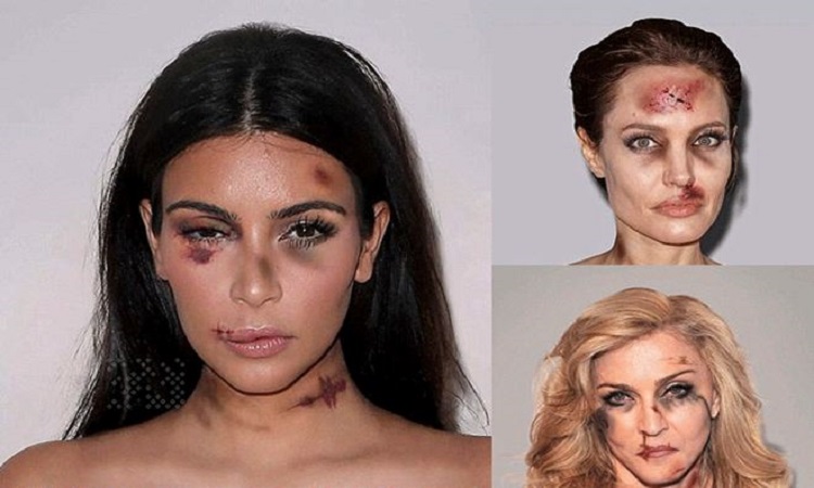 Kardashian, Jolie, Madonna κι άλλες stars θύματα κακοποίησης! Οι σοκαριστικές φωτογραφίες