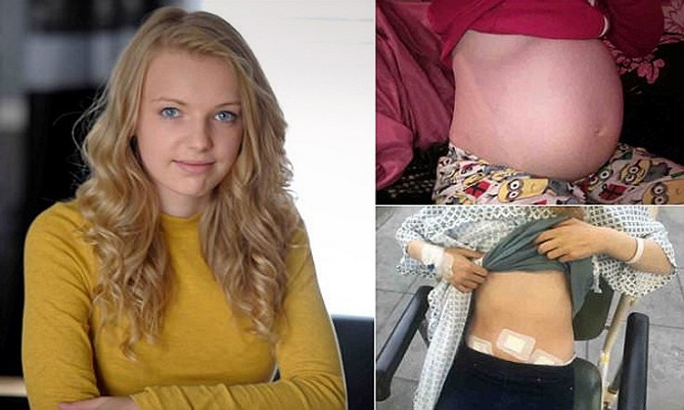 Έφηβη έμοιαζε 6 μηνών έγκυος αλλά οι γιατροί τής ανακοίνωσαν κάτι άλλο