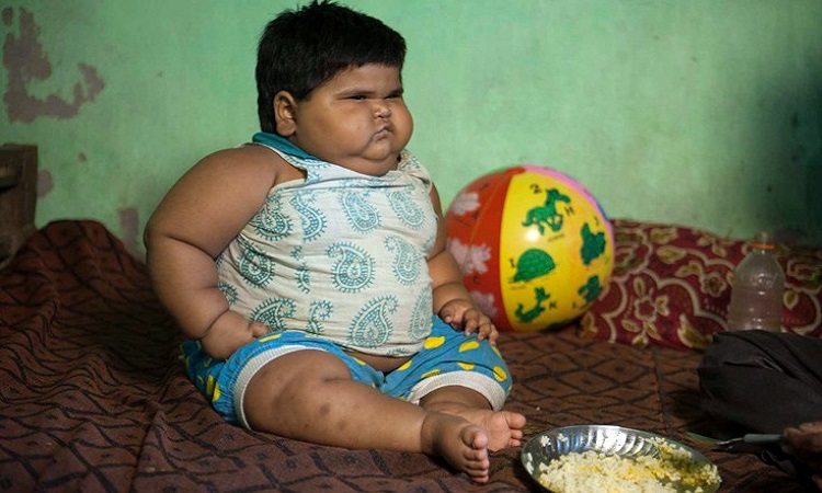Ανεξήγητη η υπόθεση του παχύσαρκου μωρού της Ινδίας - Είναι 18 μηνών και έχει βάρος 24 κιλά (ΦΩΤΟ)