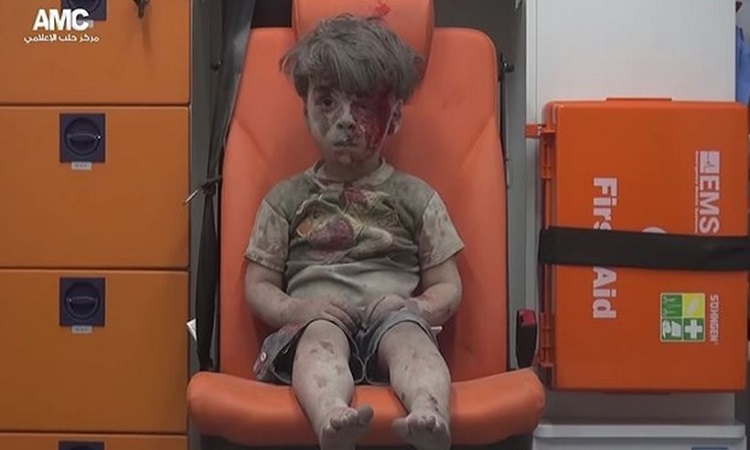 Μια εικόνα χίλιες λέξεις: 5χρονος μετά από αεροπορική επιδρομή στη Συρία (VIDEO)