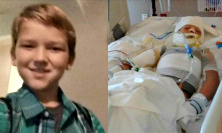10χρονος χαροπαλεύει μετά από επίθεση φίλου του!Τον έλουσε με βενζίνη και του έβαλε φωτιά