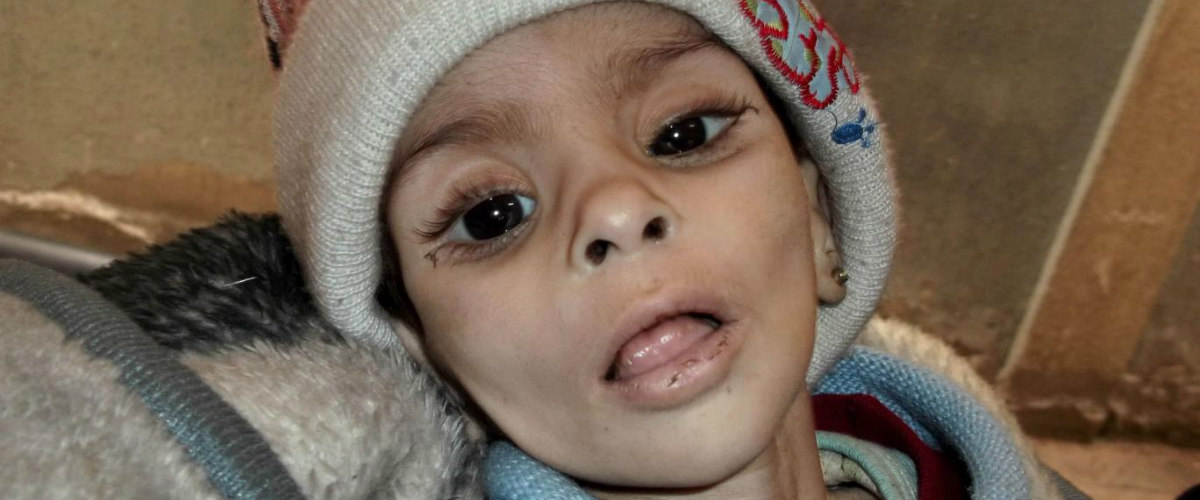 Συρία: «Είδαμε με τα ίδια μας τα μάτια ακραίως υποσιτιζόμενα παιδιά»